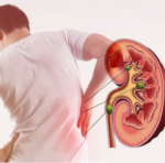 Bổ Thận – bỏ qua sẽ tiếc cả đời